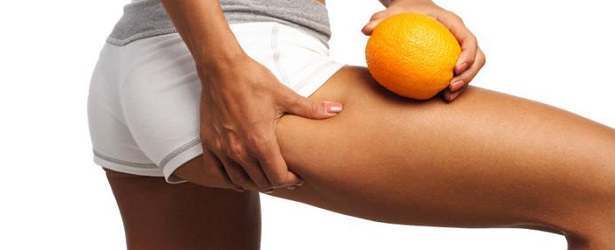 Home Remedies to Reduce Stretch Marks
